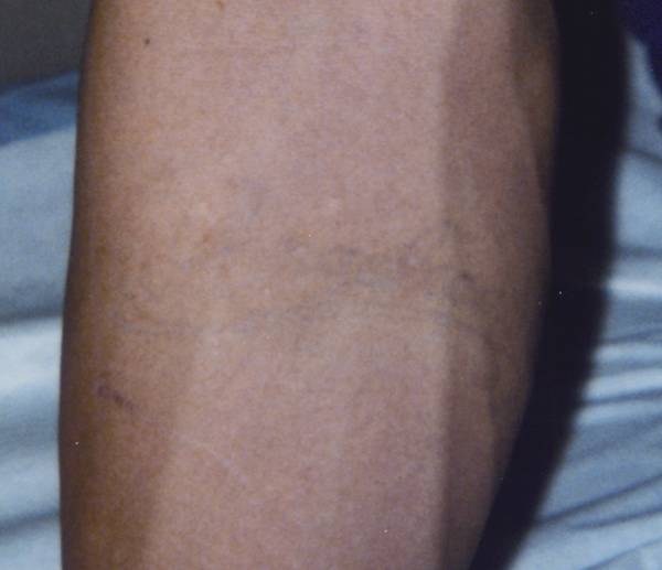 HoyaConBio 128 - LaserSpa of Tampa Bay