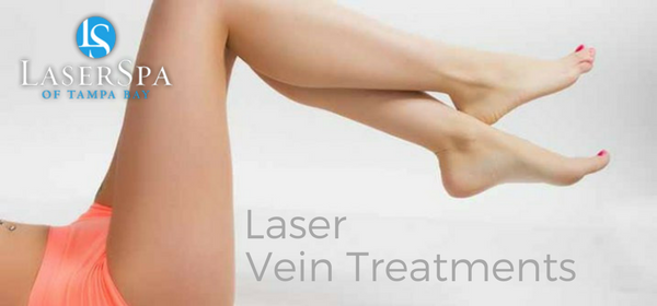 Laser Vein Treatments Tampa Bay