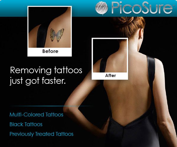 Laser Tattoo Removal Near Me - Laser Tattoo Removal Trinity - Trinity Laser Tattoo Removal - Florida